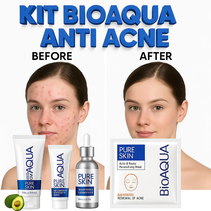 KIT ANTI ACNE BIOAQUA ORIGINAL